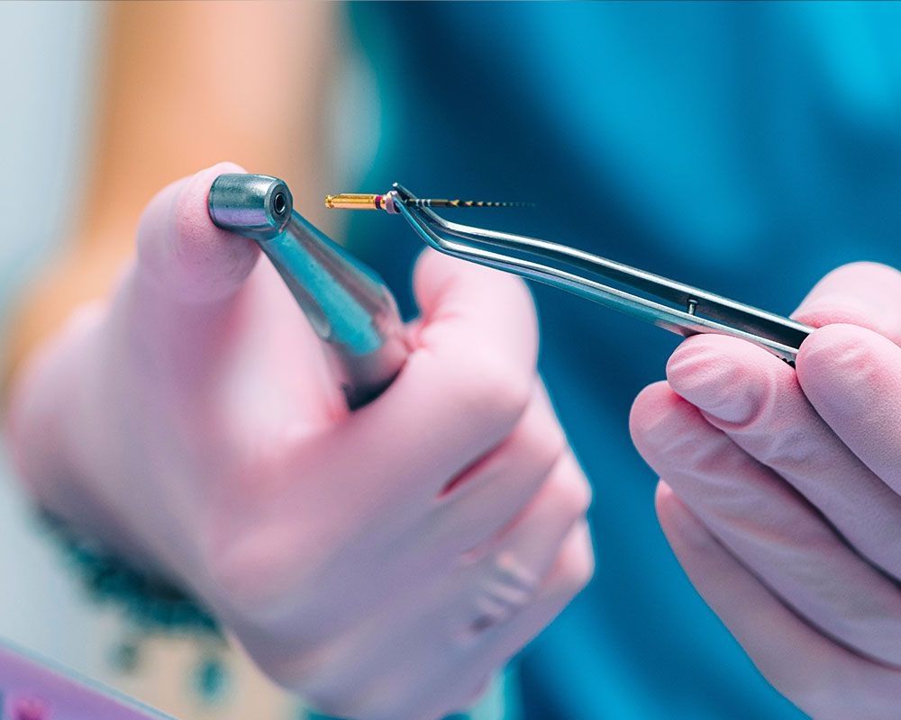 Zahnarzt oder Zahnarzthelferin hält ein Endoinstrument mit einer Pinzette und bereitet es für den Einsatz vor.